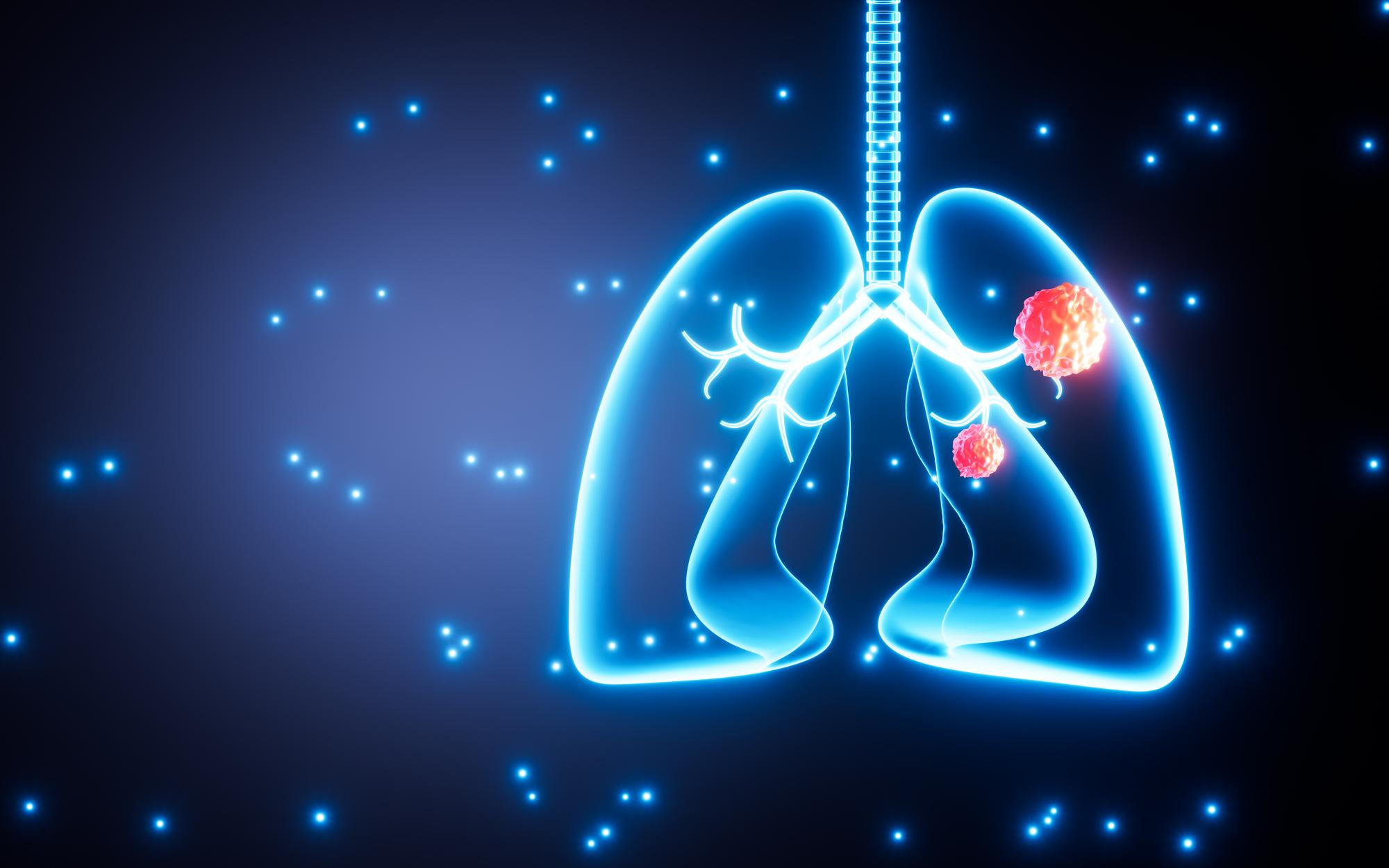 Complete Approach to Cancer Care